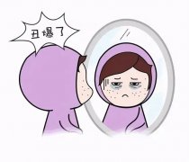 如何去除面部黄褐斑