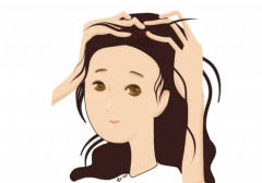 去医院看脱发要挂什么科