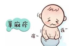 荨麻疹不能吃什么要忌些什么东西