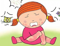 过敏性皮炎可以自愈吗